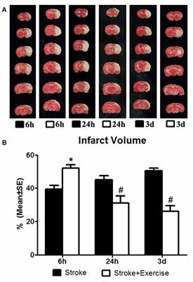 Exacerbation of Brain Injury by Post-Stroke Exercise Is Contingent Upon Exercise Initiation Timing